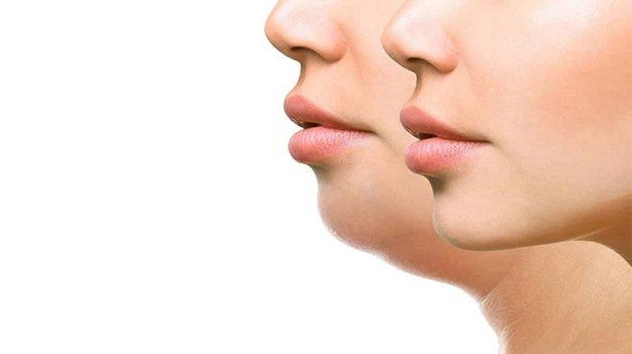 7 Cara Menghilangkan Double Chin yang Bisa Kamu Lakukan